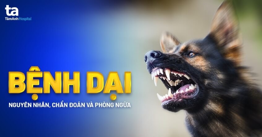 Bệnh dại: Triệu chứng, nguyên nhân, chẩn đoán và phòng ngừa