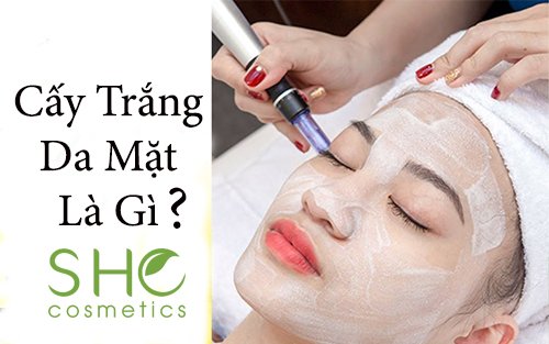 Cấy trắng da mặt là gì? Có tốt không? Có nên thực hiện không?