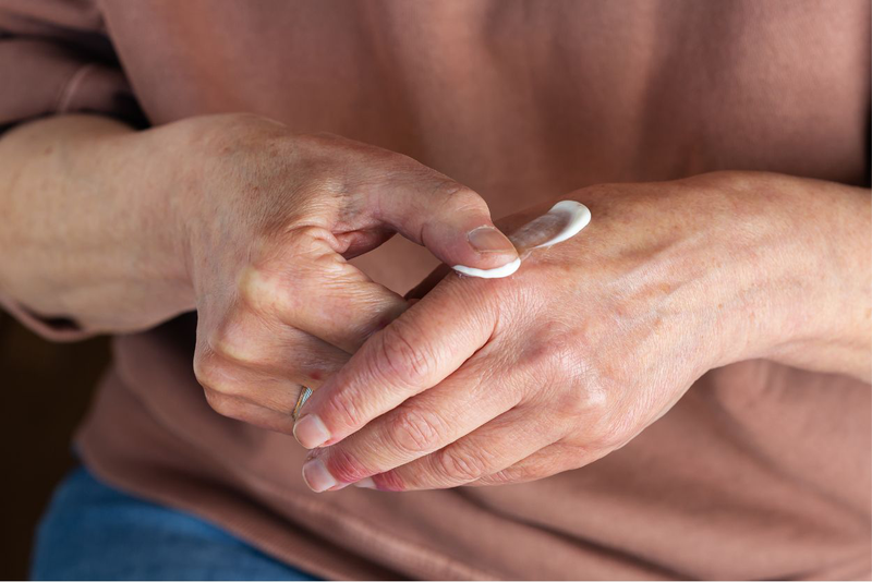 Bệnh nấm da tay: Nguyên nhân, triệu chứng và cách điều trị