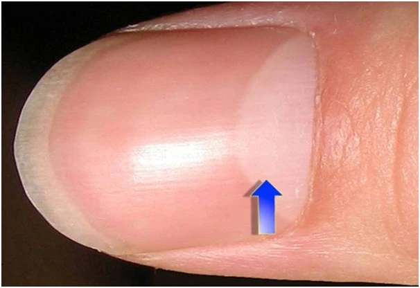 Ý Nghĩa Của Phần Trắng Ở Móng Tay Bạn Cần Biết