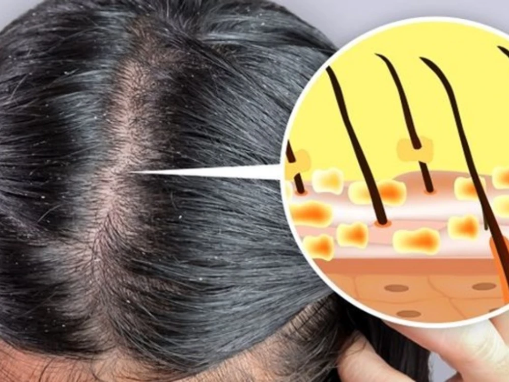 Hoa cứt lợn: Dược liệu quý có nhiều tác dụng với sức khỏe