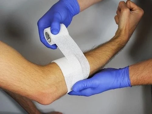 Nguy cơ tay chảy máu và cách xử lý kịp thời