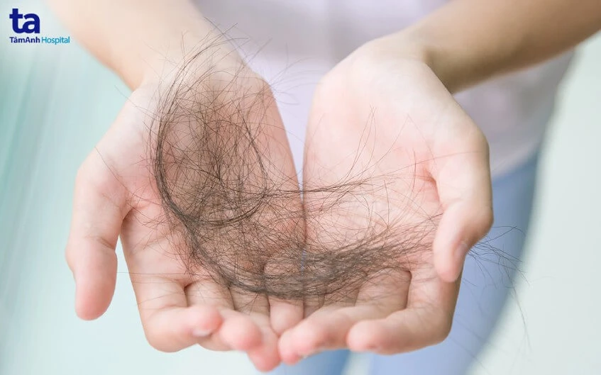 Hóa trị là gì? Liệu pháp hóa trị ung thư có nguy hiểm không? 