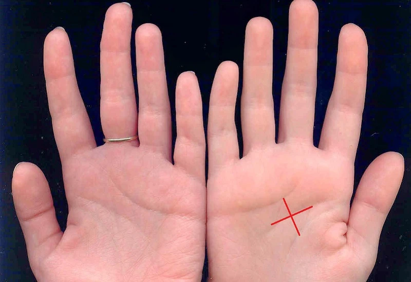 Khám Phá Bàn Tay Chữ X Đặc Biệt