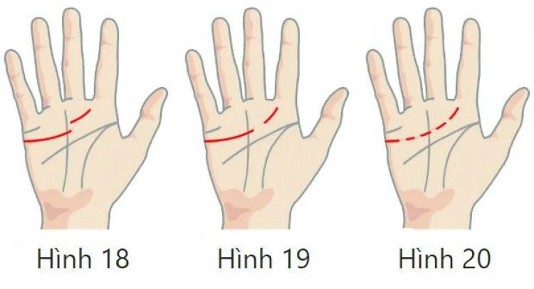 Xem Chỉ Tay Đường Tình Duyên Biết Ngay Hôn Nhân Nam Nữ, Tốt Hay Xấu