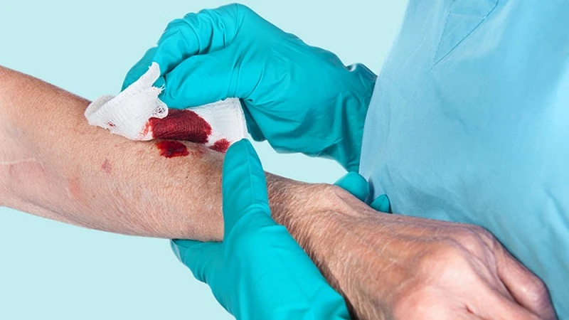 Những cách cầm máu nhanh nhanh chóng khi bị thương tại nhà