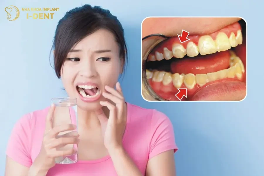 Các Tác Hại Của Tẩy Trắng Răng Bạn Nên Biết