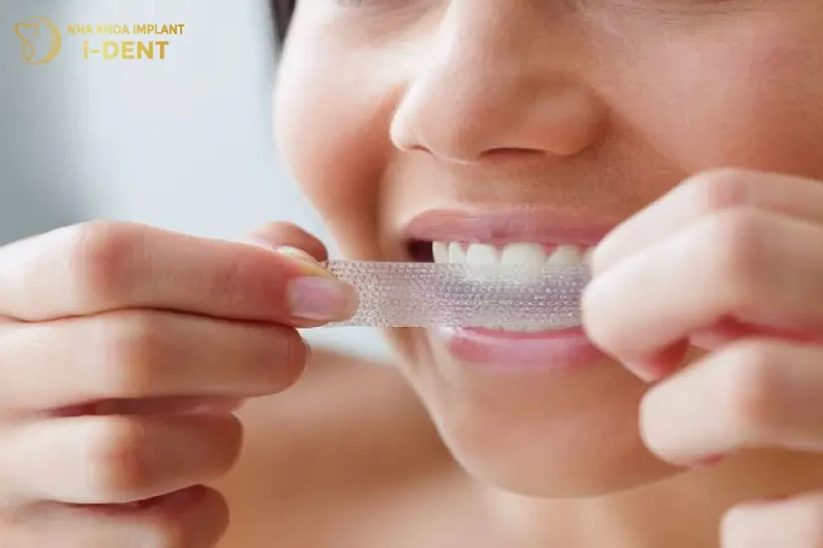 Tẩy trắng răng có hại không và các phương pháp an toàn