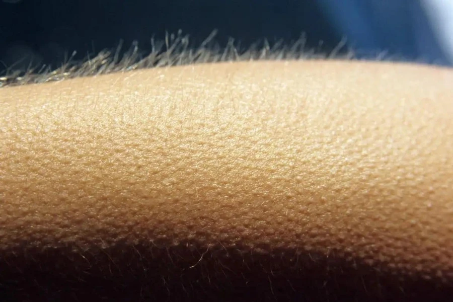 Con gái lông tay nhiều thì sao? Tốt hay xấu?