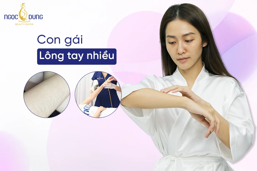 Nguyên nhân khiến con gái nhiều lông tay và hormone