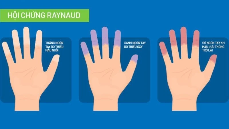 Tinh dầu hoa anh thảo là gì? 10 tác dụng, cách dùng và lưu ý khi sử dụng