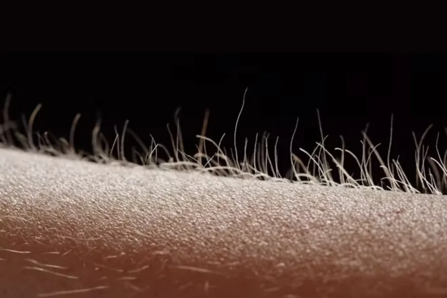 Con gái lông tay nhiều thì sao? Tốt hay xấu?