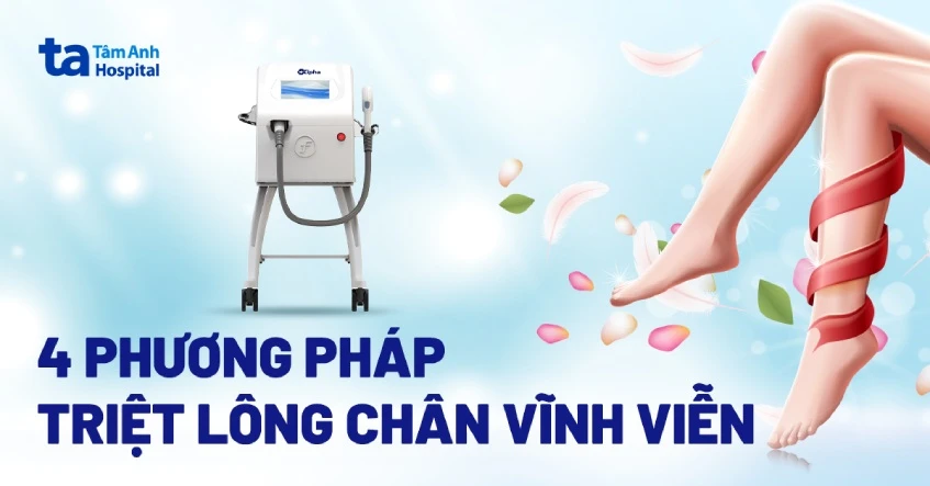 Cách tẩy lông chân không mọc lại hiệu quả an toàn