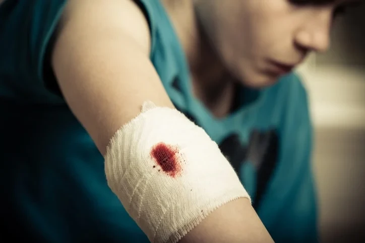 7 cách cầm máu nhanh tại nhà khi bị thương