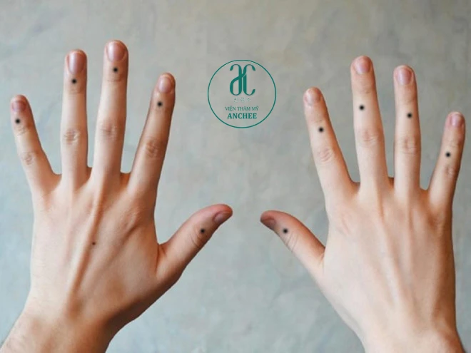 Xem Tướng Nốt Ruồi Ngón Tay Cái Trái Phải Nam & Nữ Nói Lên Điều Gì?