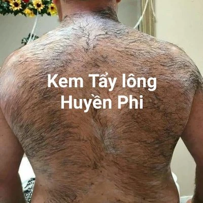 Kem tẩy lông huyền phi tặng kèm serum triệt