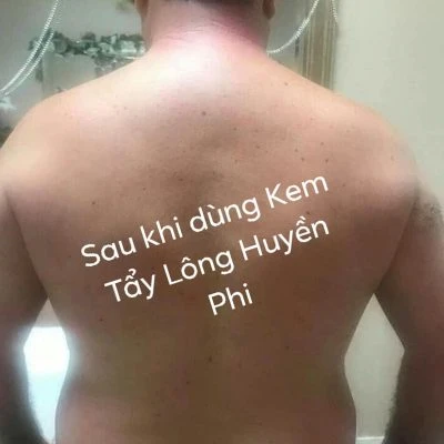 Kem tẩy lông huyền phi tặng kèm serum triệt
