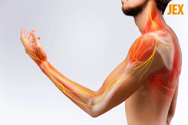 Cách giảm đau nhức cánh tay hiệu quả và an toàn