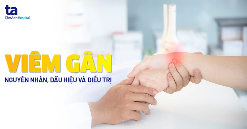 Cách điều trị viêm gân cổ tay tại nhà hiệu quả