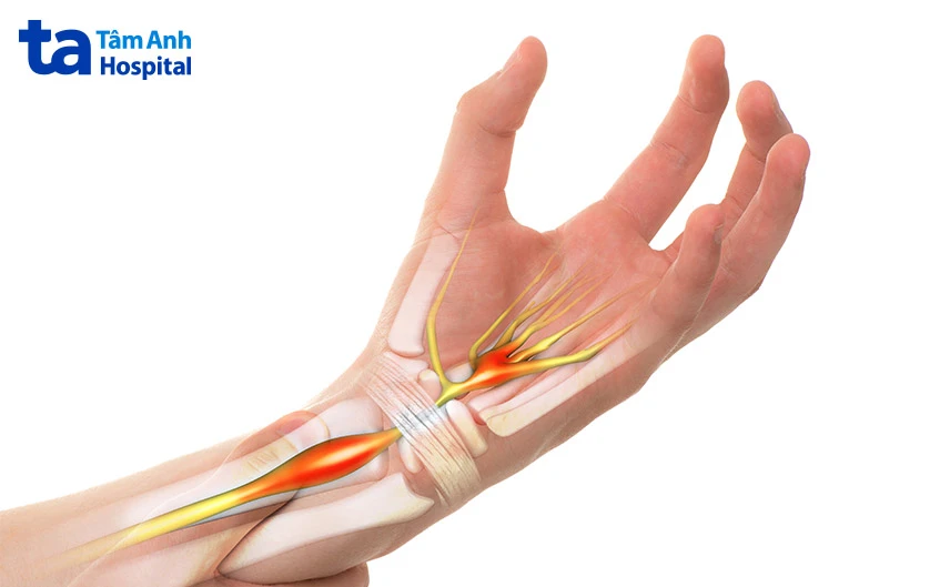 Cổ tay là gì? Cấu tạo, chức năng trong cơ thể người