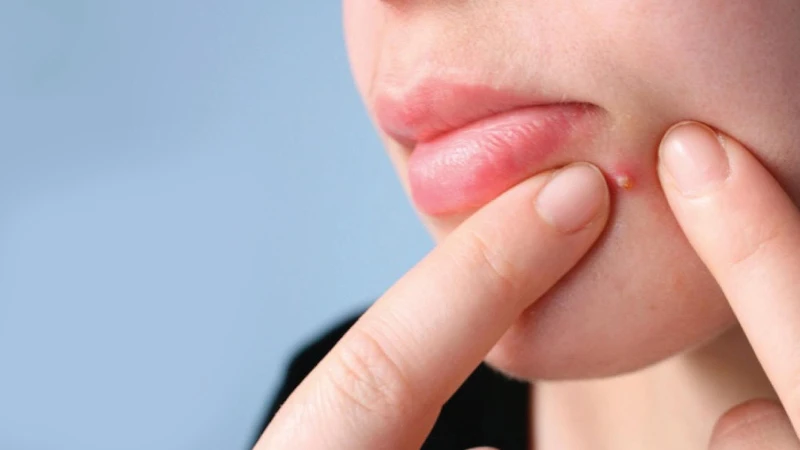 Uống tinh dầu hoa anh thảo đúng cách, hiệu quả