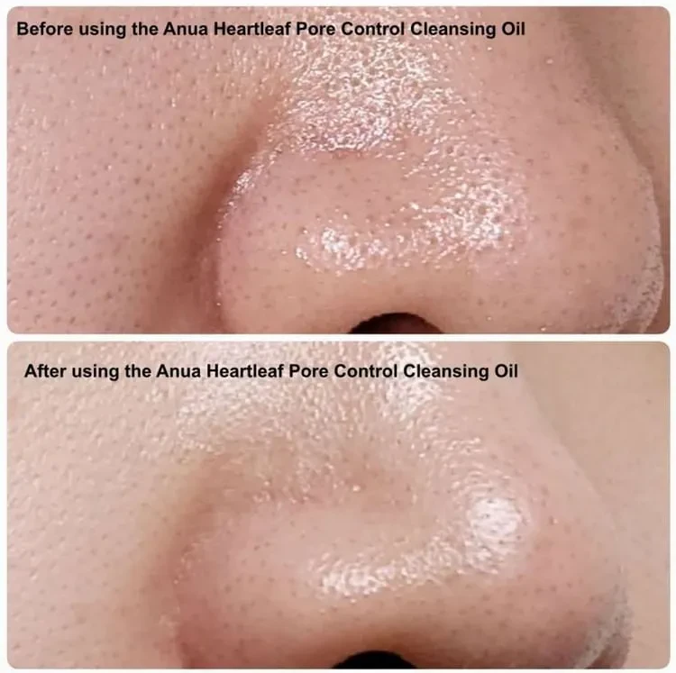 Dầu Tẩy Trang Anua Heartleaf Pore Control Cleansing Oil 200ml | SonAuth