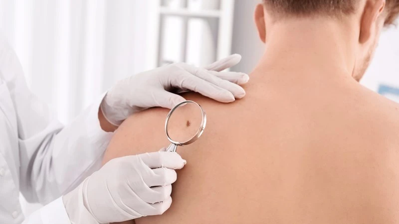 Viêm nang lông: Nguyên nhân, dấu hiệu và cách điều trị hiệu quả