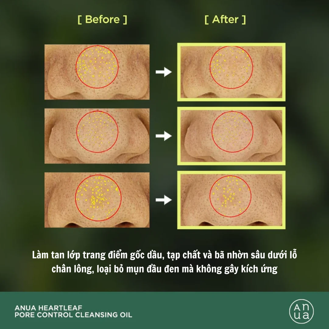 Dầu Tẩy Trang Anua Heartleaf Pore Control Cleansing Oil 200ml | SonAuth