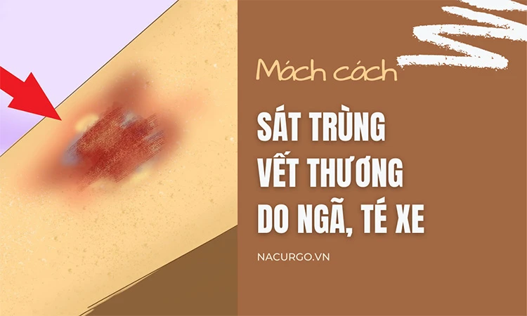 Té xe trầy tay và nguy cơ nhiễm trùng cần lưu ý