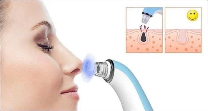 Máy hút mụn cầm tay loại nào tốt nhất hiện nay