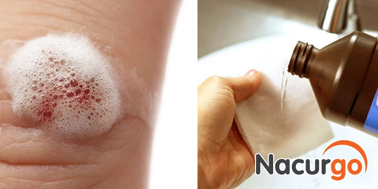 Hướng dẫn cách sát trùng vết thương bị ngã, té xe tránh nhiễm trùng!