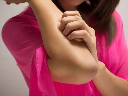 Nhận diện dấu hiệu bệnh gan qua lòng bàn tay son