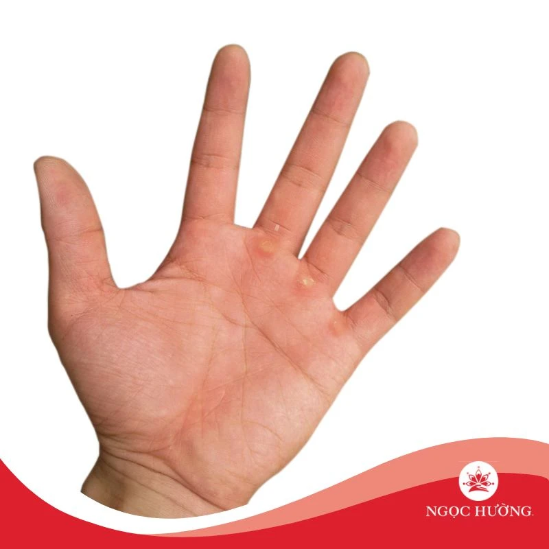 Tướng bàn tay phụ nữ khổ, không gặp nhiều may mắn