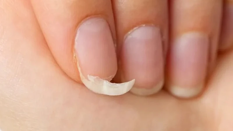 Nhìn móng tay đoán bệnh, bạn đã biết chưa?