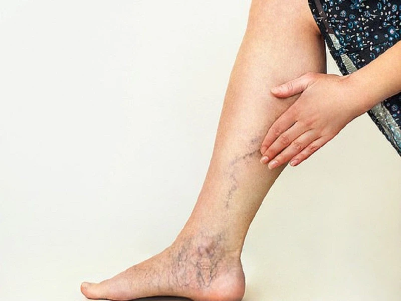 Đau nhức bắp chân về đêm là dấu hiệu bệnh gì? Các biện pháp giảm đau