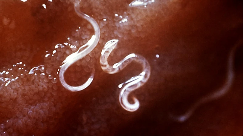 Không tẩy giun có sao không? Tần suất tẩy giun hợp lý