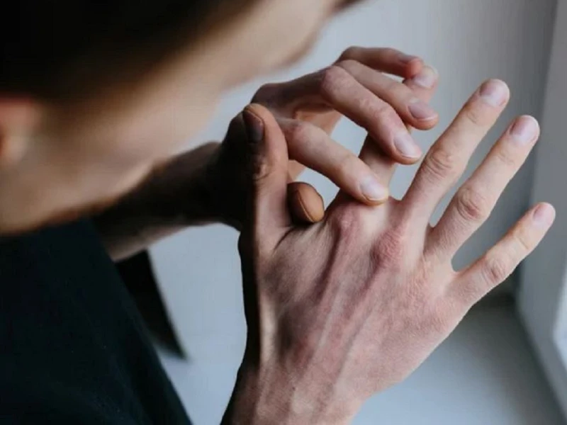 Ngứa lòng bàn tay phải và những nguyên nhân tiềm ẩn