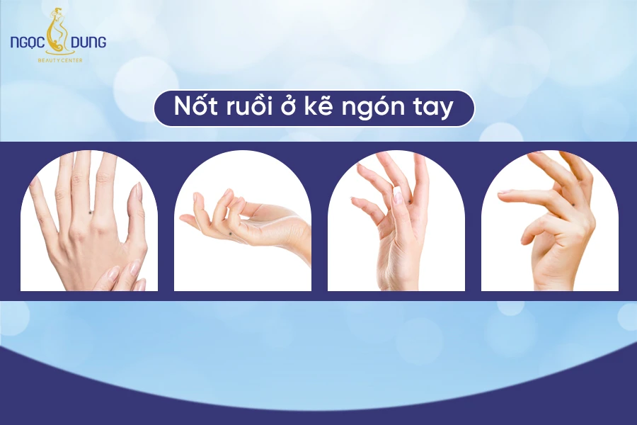 Ý Nghĩa Nốt Ruồi Ngón Tay Giữa Trong Tính Cách Con Người