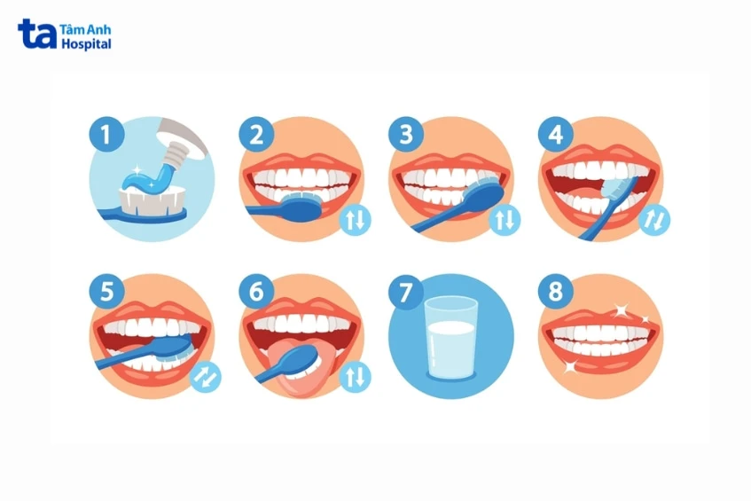 Răng ố vàng: Nguyên nhân, cách khắc phục và hạn chế ngả vàng