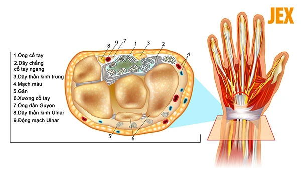 Trật khớp cổ tay: Nguyên nhân, dấu hiệu và cách chữa trị tại nhà