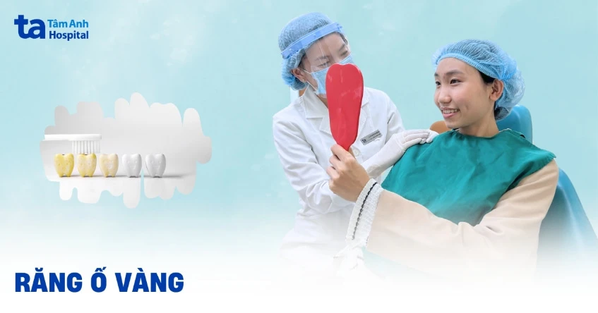 Giải pháp tẩy răng ố vàng hiệu quả và an toàn