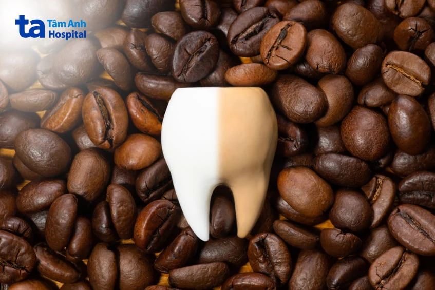 Răng ố vàng: Nguyên nhân, cách khắc phục và hạn chế ngả vàng