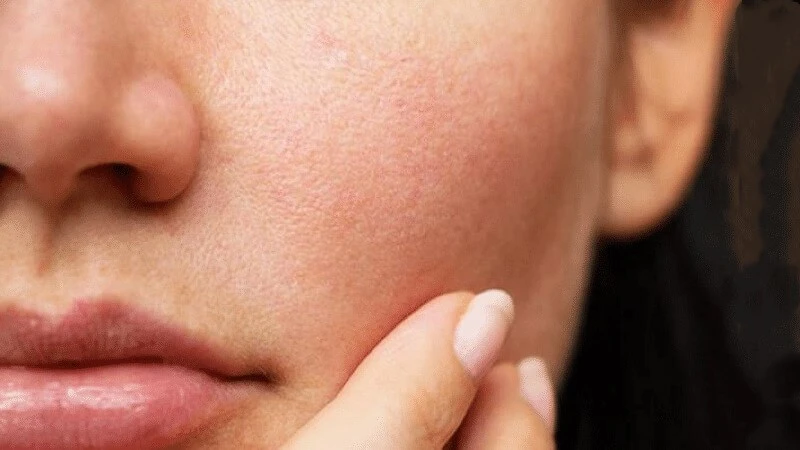 Top 21 loại mặt nạ giấy tốt cho da được các chị em ưa chuộng