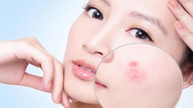 Top 21 loại mặt nạ giấy tốt cho da được các chị em ưa chuộng