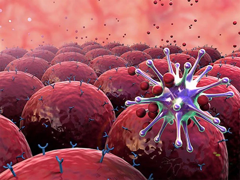 Truyền hóa chất sống được bao lâu trong điều trị ung thư