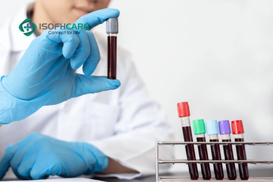 Cách xem nhóm máu trong giấy xét nghiệm chính xác